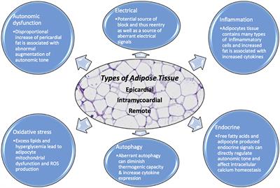 Linking Arrhythmias and Adipocytes: Insights, Mechanisms, and Future Directions